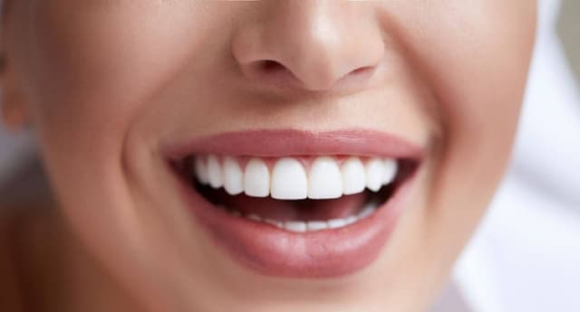 Imagen /images/diseño-sonrisa.jpg